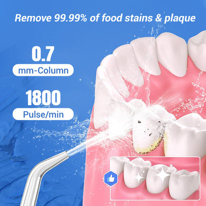 Portable Oral Irrigator – Water Flosser